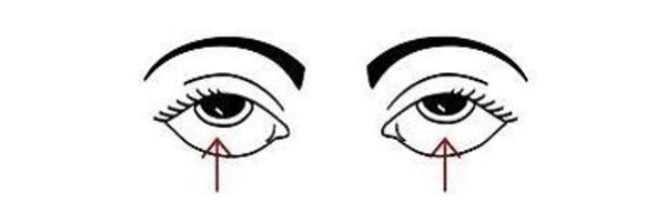 تمارين إراحة العين - التمرين الثاني