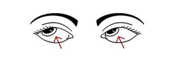 تمارين إراحة العين - التمرين الثالث