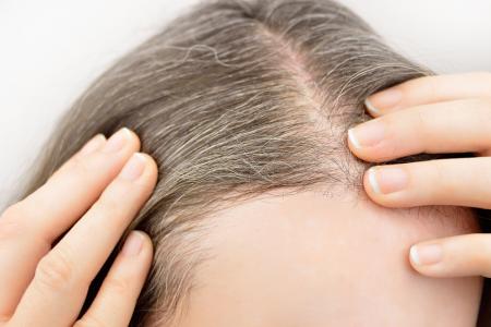 الشعر الأبيض على الرأس