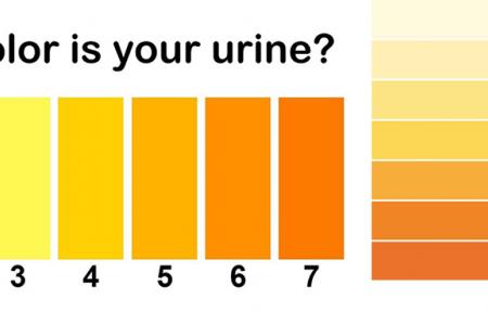 أنواع ألوان البول و دلالاته الصحية